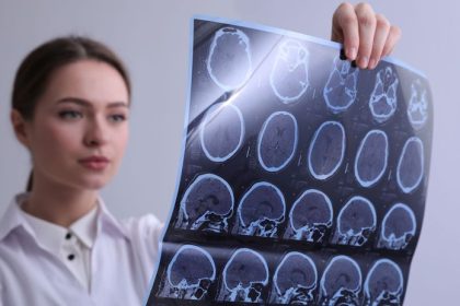 Vedci tvrdia ze test odhali vasu dlzku zivota