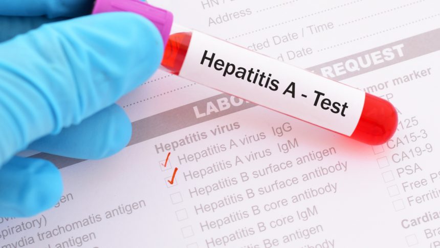 Na juhu Slovenska potvrdili hepatitidu typu A Kontaktne osoby zaockovali obec varuje obyvatelov Regiony Spravy