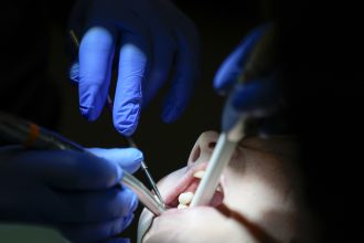 Ziadne korunky ani implantaty Vedci chcu donutit telo aby si nove zuby vypestovalo samo