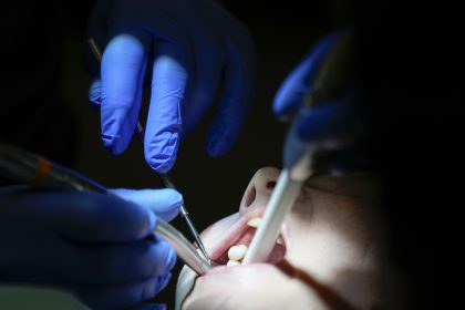 Ziadne korunky ani implantaty Vedci chcu donutit telo aby si nove zuby vypestovalo samo
